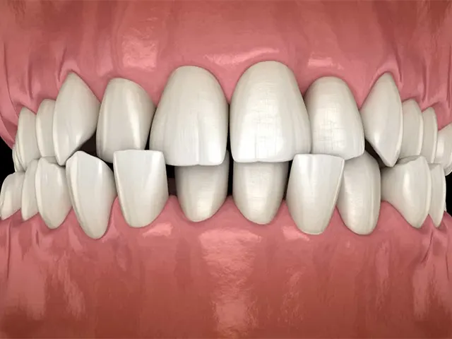 مشکلات قابل حل با ارتودنسی