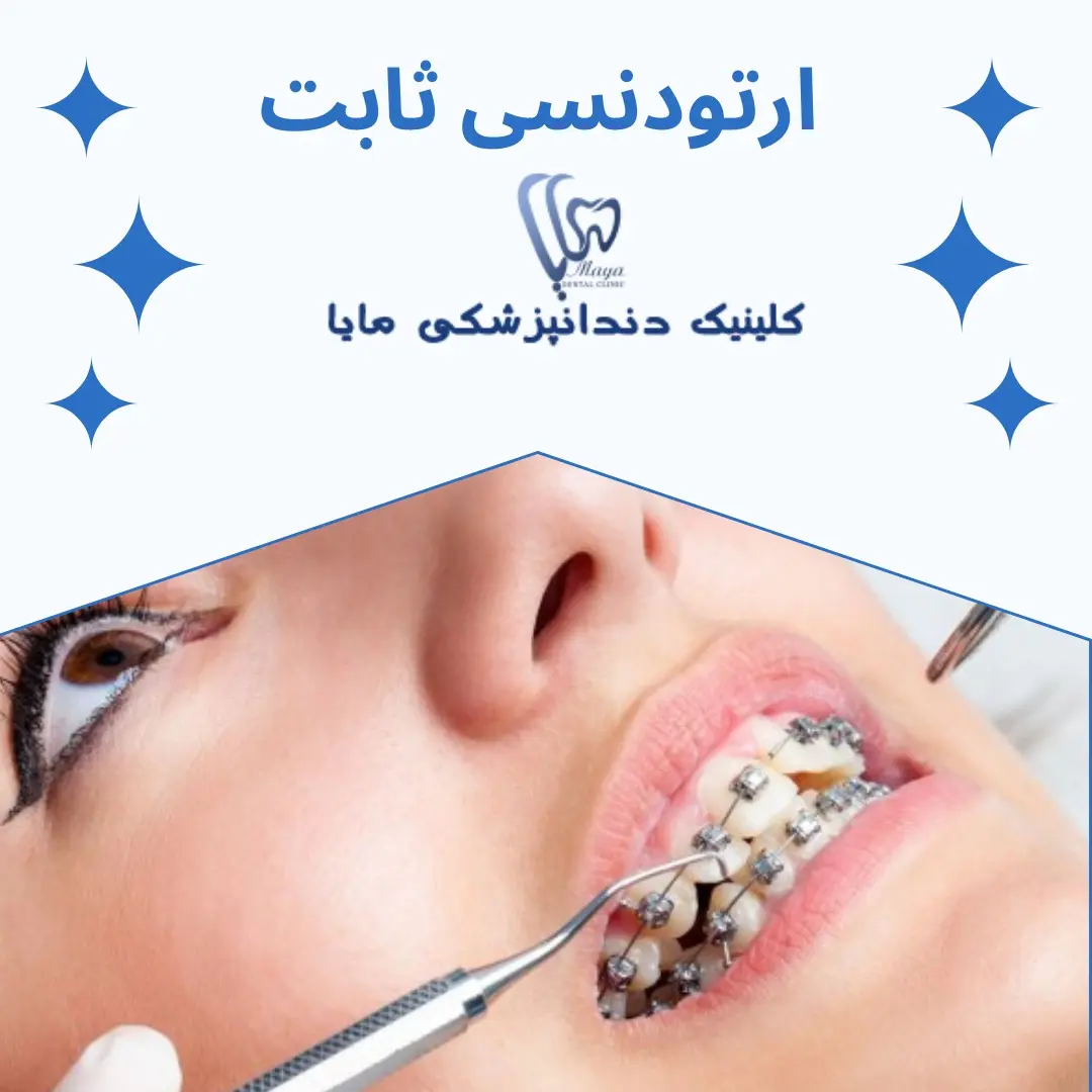 ارتودنسی ثابت