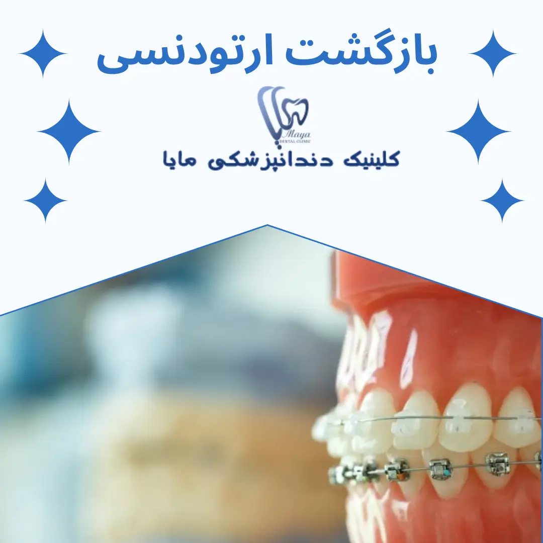بازگشت ارتودنسی
