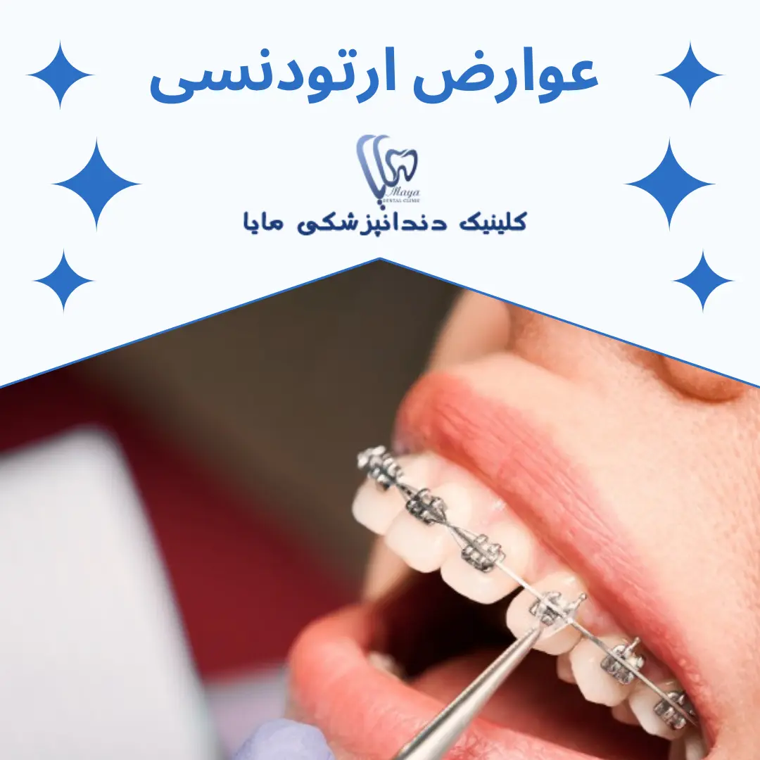 بررسی عوارض ارتودنسی دندان