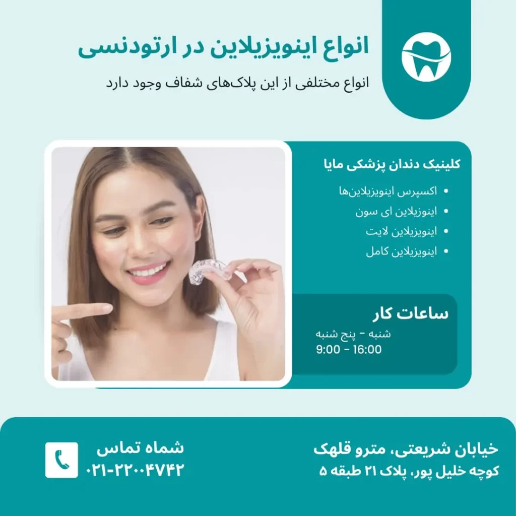 انواع ایزویزیلاین در ارتودنسی