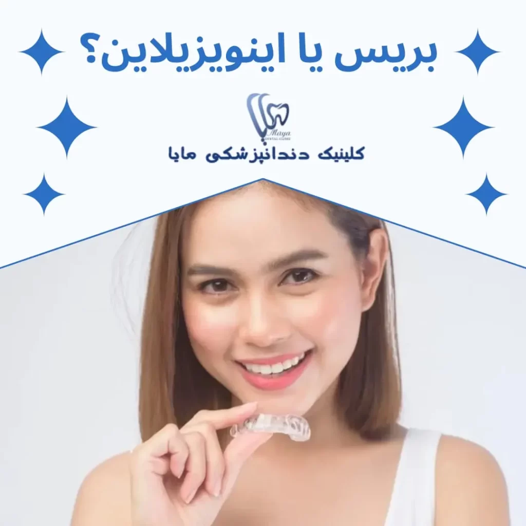 بریس بهتر است یا اینویزیلاین؟