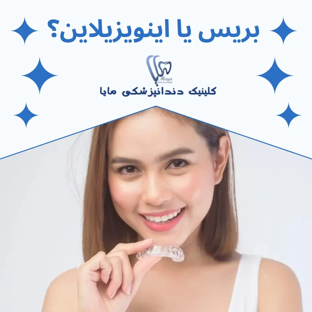 بریس بهتر است یا اینویزیلاین؟