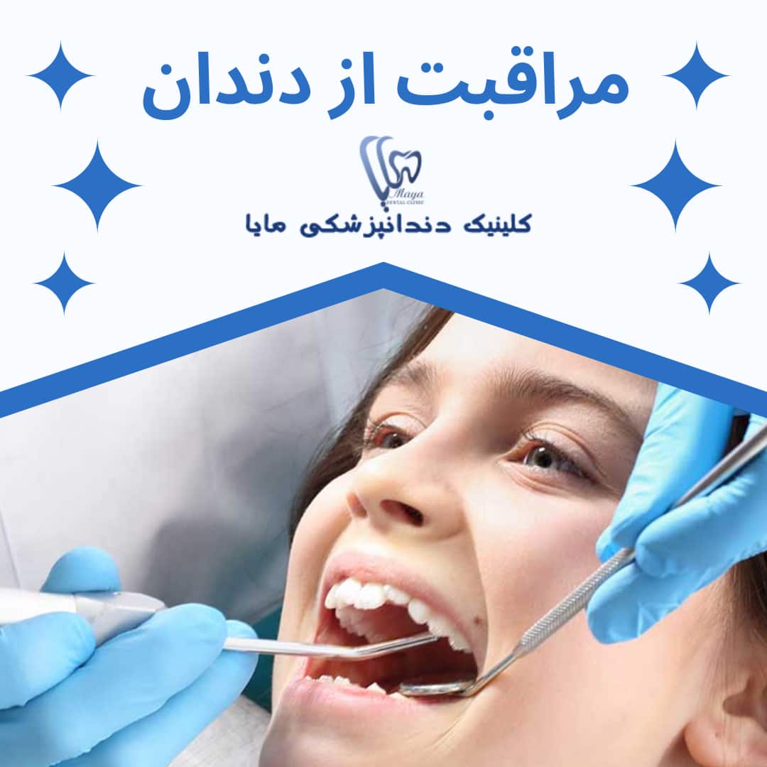 مراقبت از دندان