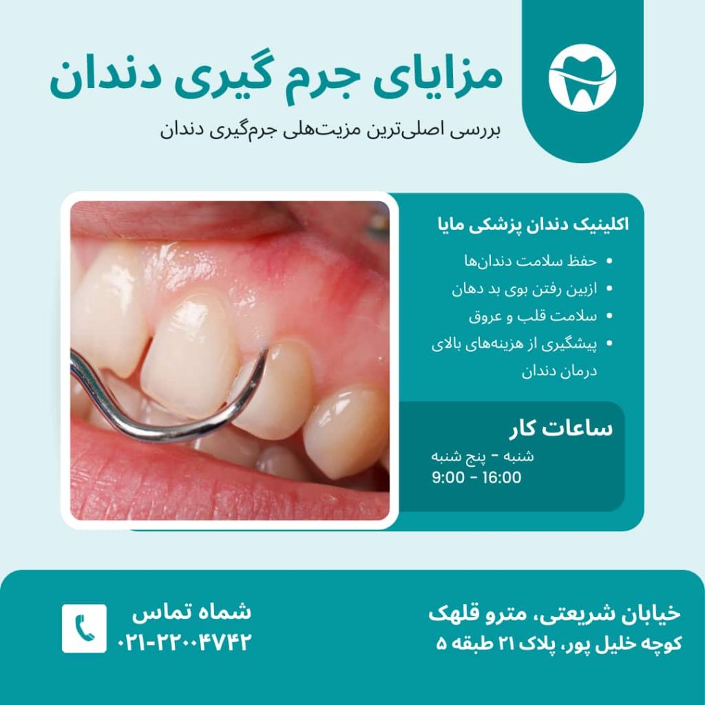 مزایای جرم گیری دندان