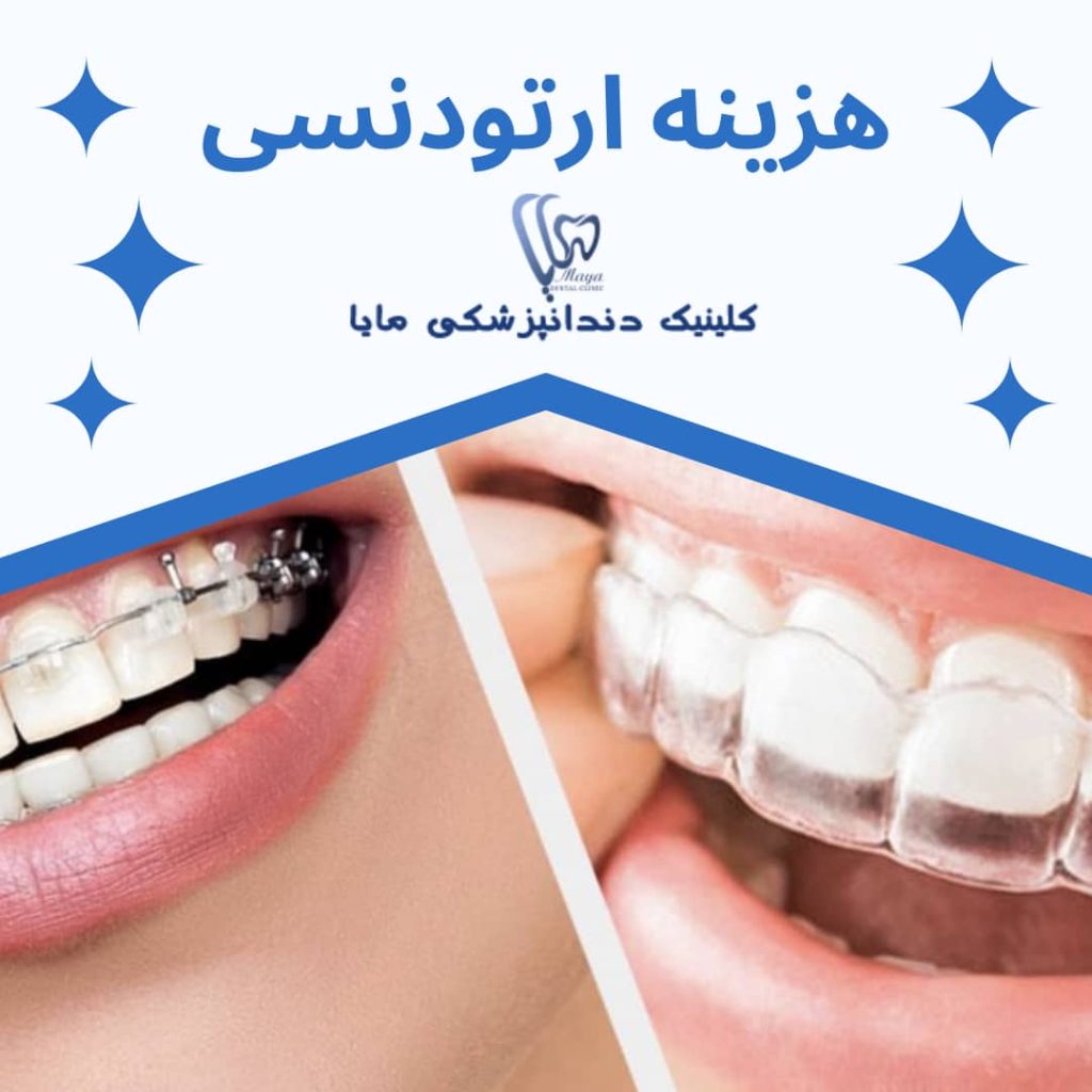هزینه ارتودنسی در سال 1402