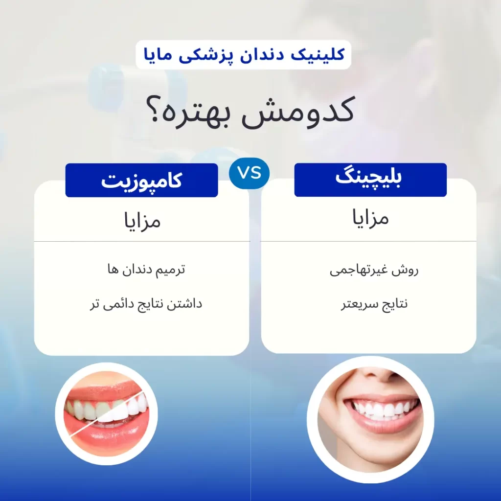 مقایسه بلیچینگ و کامپوزیت