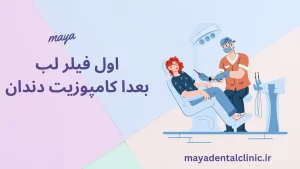 اول فیلر لب بعدا کامپوزیت دندان