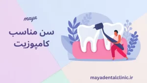 سن مناسب کامپوزیت دندان