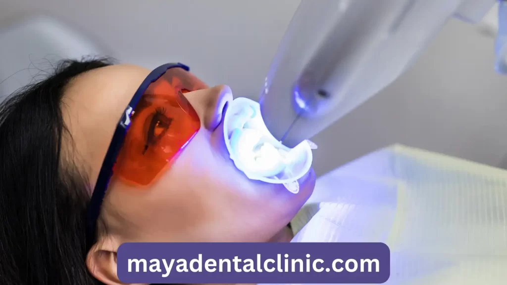 Laser bleaching teeth at dantist room. Teeth whitening for woman. Bleaching of the teeth at dentist clinic. Dental care.