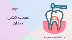 عصب کشی دندان
