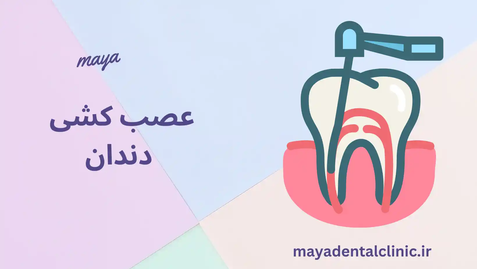 عصب کشی دندان