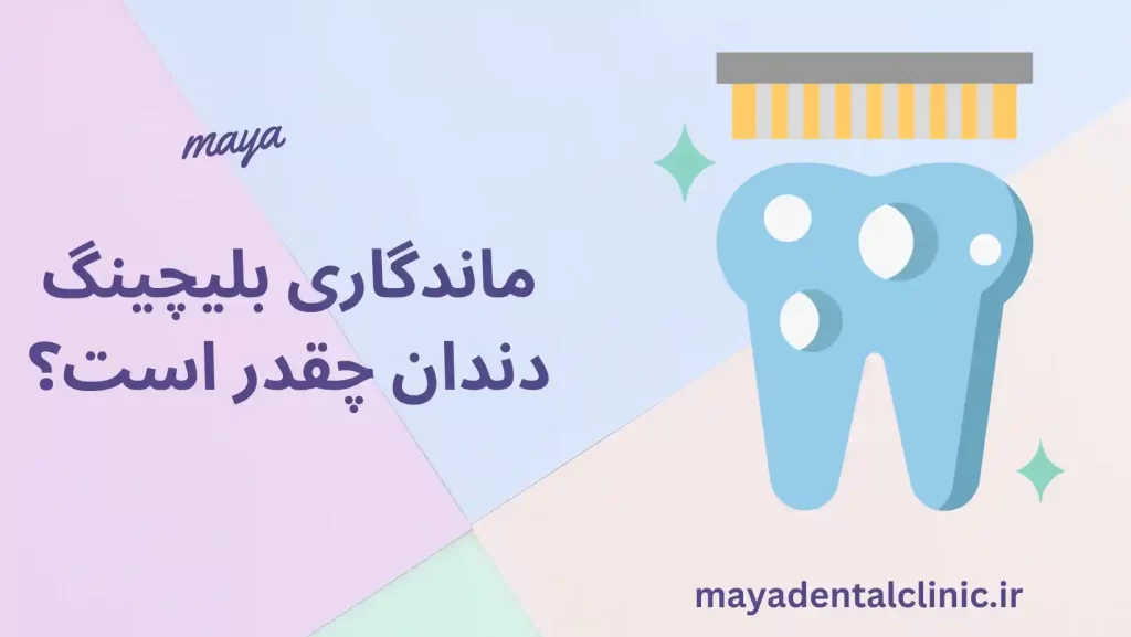 ماندگاری بلیچینگ دندان چقدر است؟ کاور