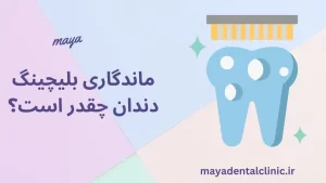 ماندگاری بلیچینگ دندان چقدر است؟ کاور