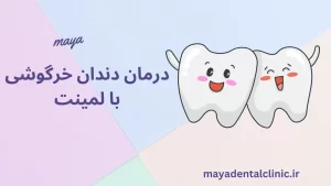 درمان دندان خرگوشی با لمینت