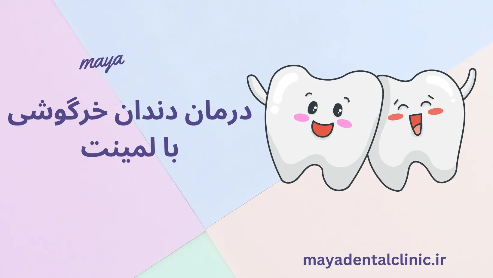 درمان دندان خرگوشی با لمینت