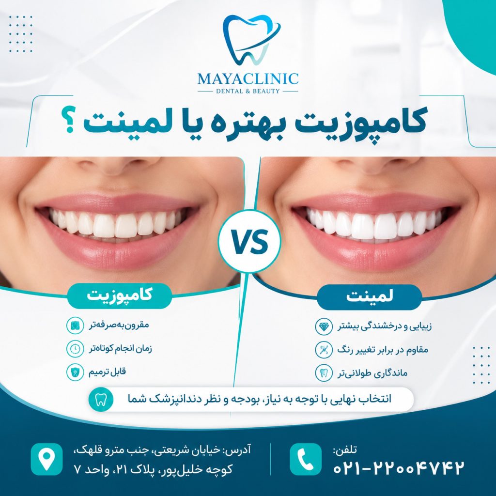 کامپوزیت بهتره یا لمینت