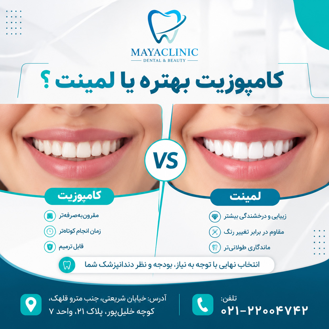 کامپوزیت بهتره یا لمینت