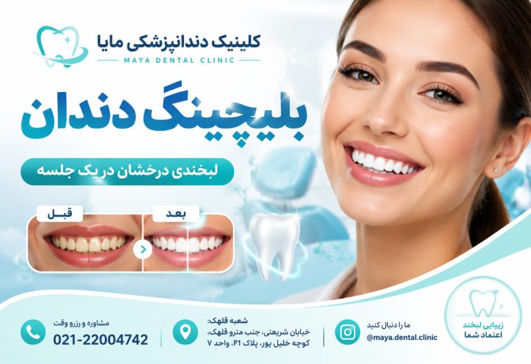 بلیچینگ دندان تهران