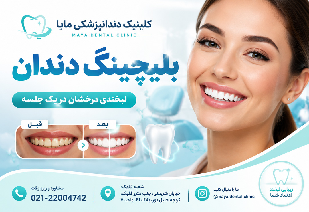 بلیچینگ دندان تهران