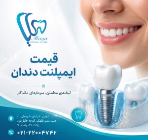 قیمت ایمپلنت دندان