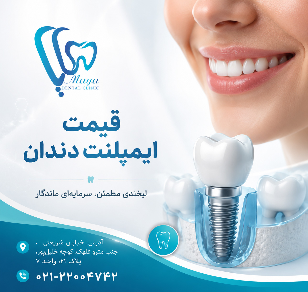 قیمت ایمپلنت دندان