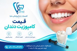 قیمت کامپوزیت دندان