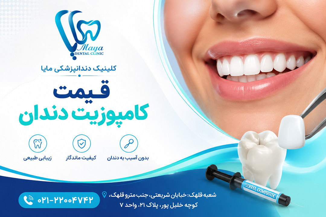 قیمت کامپوزیت دندان