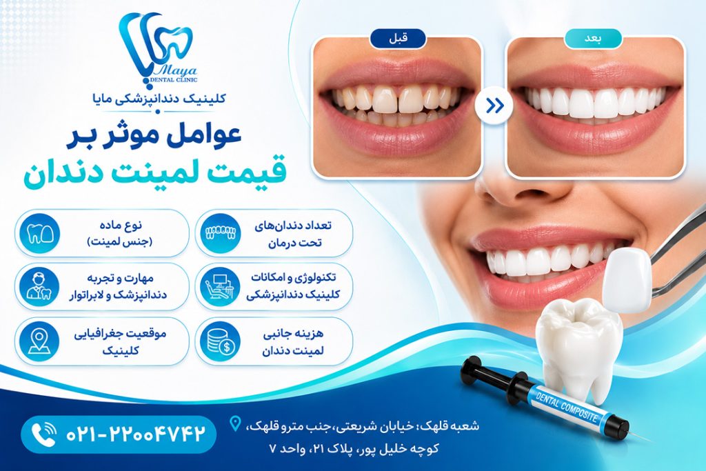 عوامل موثر بر قیمت لمینت دندان