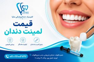 قیمت لمینت دندان