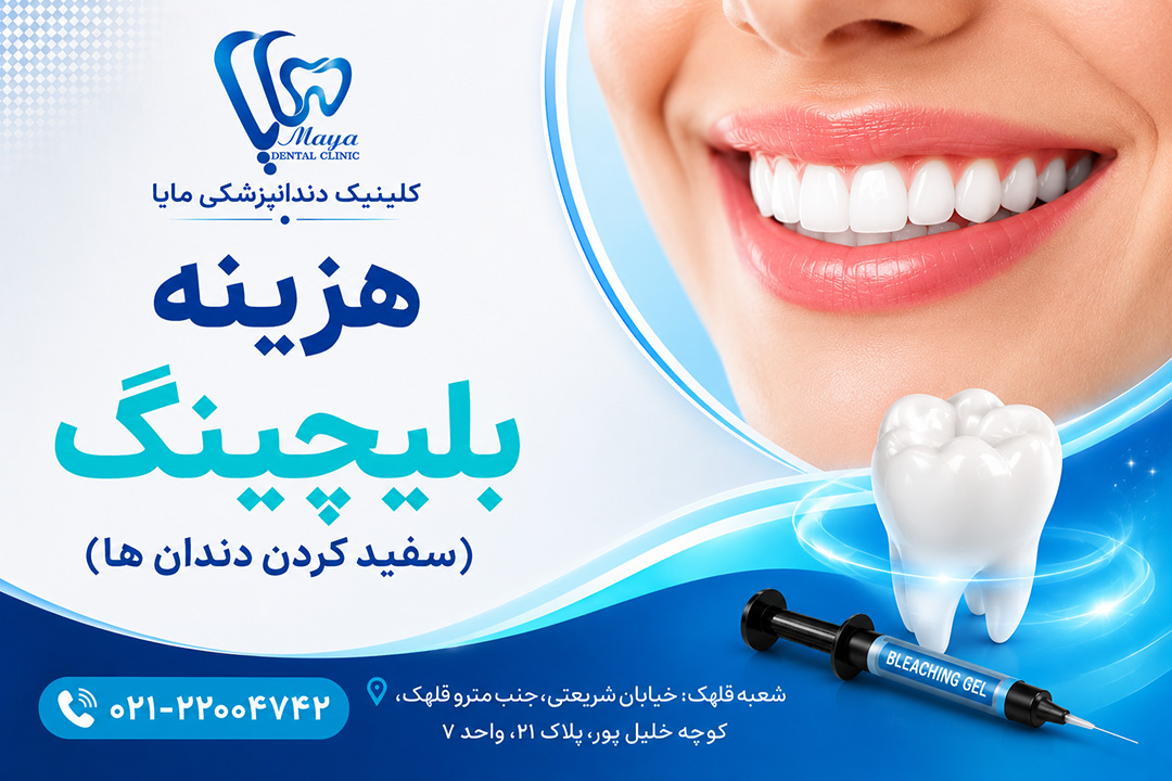 هزینه بلیچینگ دندان